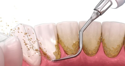 blog image
