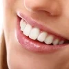 Gülüş Tasarımı