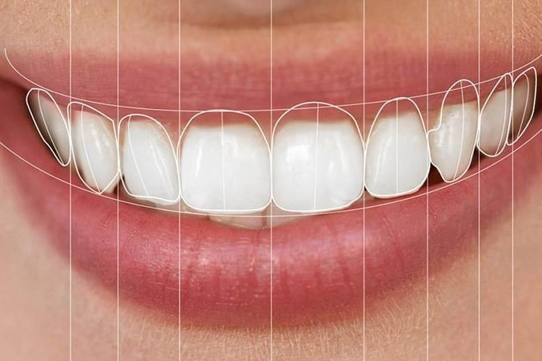 Gülüş Tasarımı Nedir?